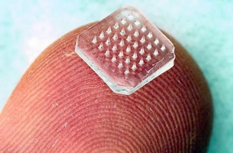 Angst vor Spritzen? Jetzt kommt die schmerzfreie Injektion mit “Micro-Needles”