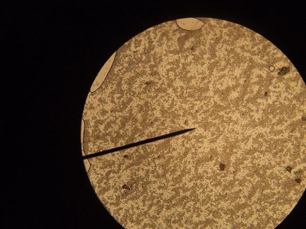 Hefezellen unter dem Mikroskop