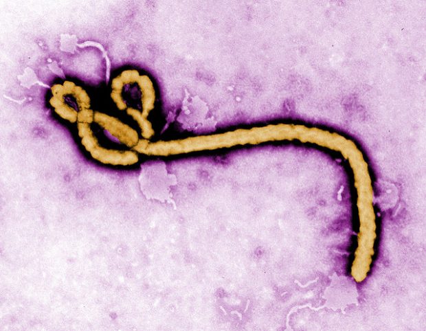 Foto:  Ebola Virus, CDC Global, Flickr, CC BY-SA 2.0