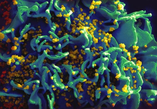 HIV-infizierte T-Zelle