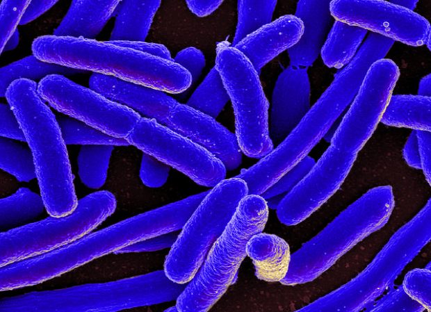  E. coli Bacteria, NIAID, Flickr, CC BY-SA 2.0