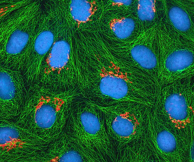Bis heute sind HeLa-Zellen einzigartig. Foto:  Multiphoton fluorescence image of cultured HeLa cells, NIH Image Gallery, Flickr, CC BY-SA 2.0